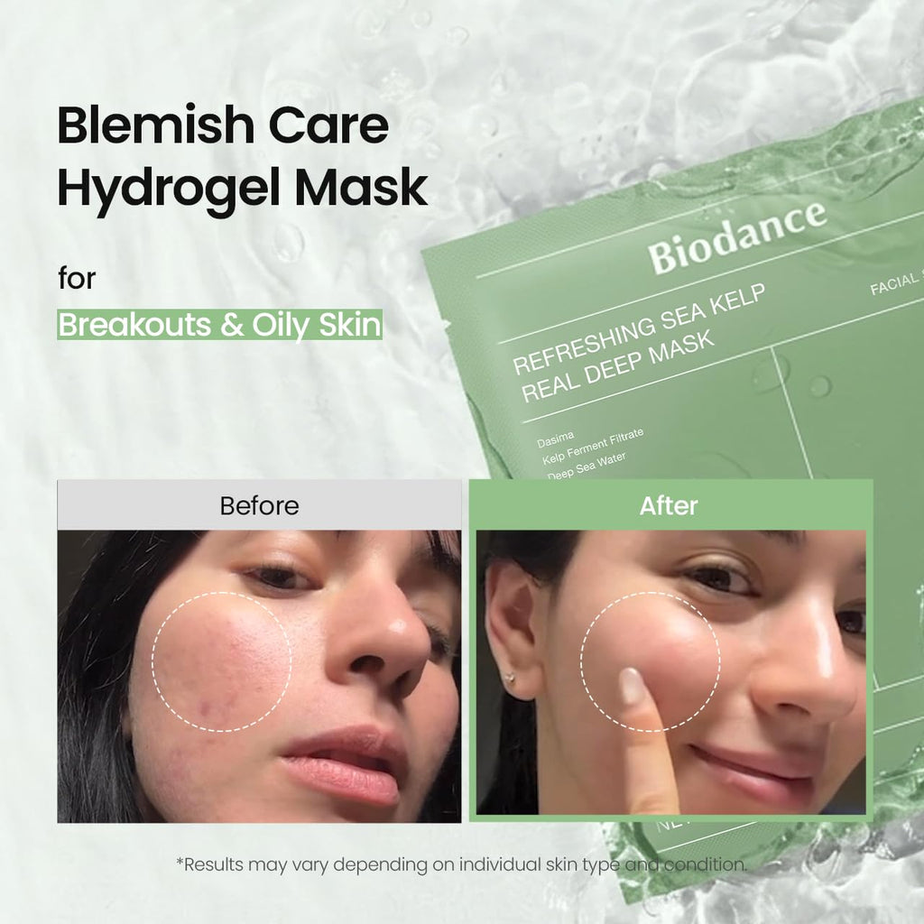 BIODANCE Bio-Collagen Real Deep Mask, Hydrating Overnight Hydrogel Face Mask, Pore Minimizing, Plumping, Elasticity Improvement, Korean Skin Care, Self Care Gifts for Women | 1.19oz(34g) x 16ea