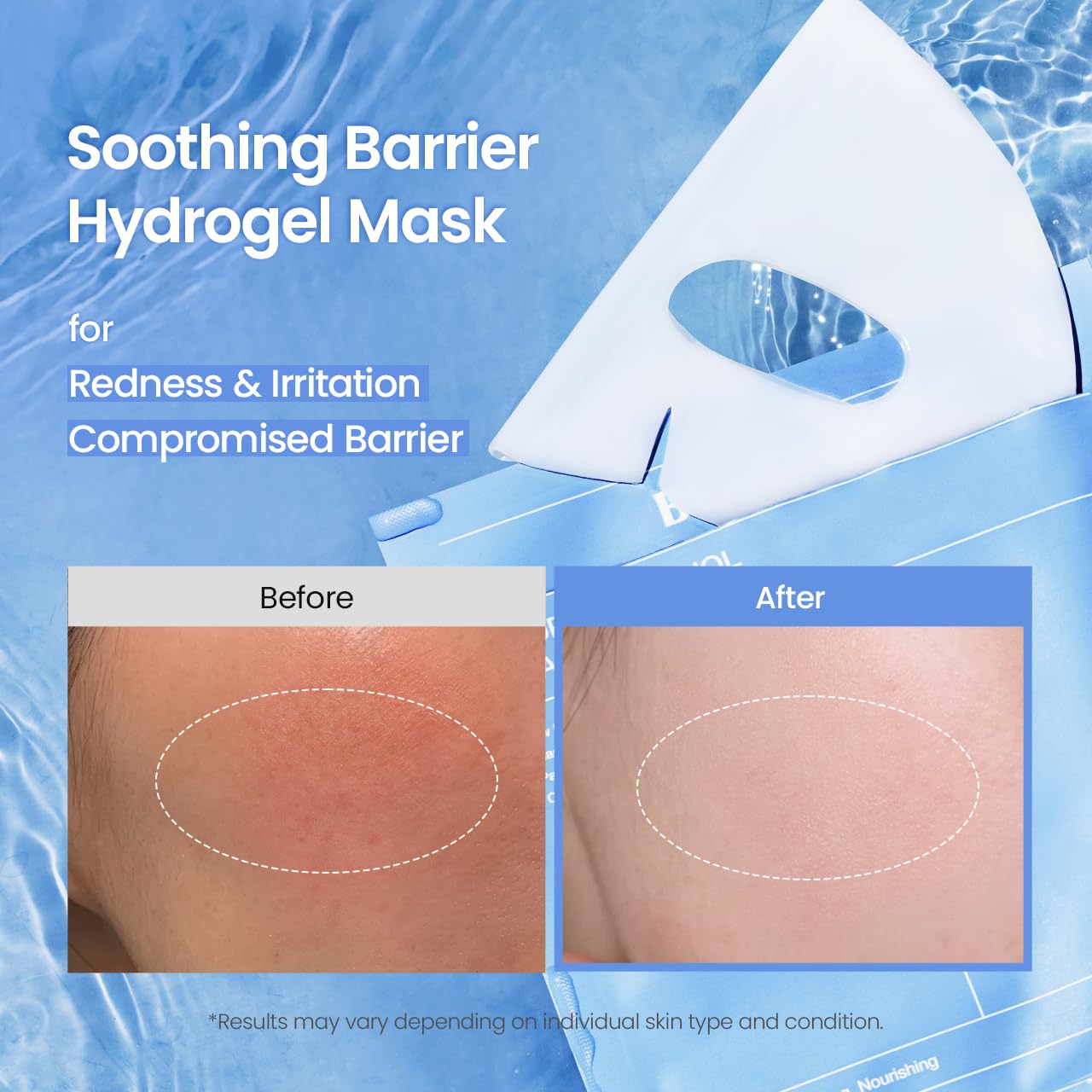 BIODANCE Bio-Collagen Real Deep Mask, Hydrating Overnight Hydrogel Face Mask, Pore Minimizing, Plumping, Elasticity Improvement, Korean Skin Care, Self Care Gifts for Women | 1.19oz(34g) x 16ea